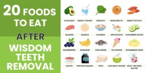 Essential Guide to Nutrition After Wisdom Teeth Removal