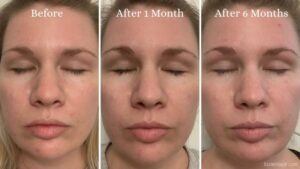 Herbal Face Food: A Natural Path to Radiant Skin